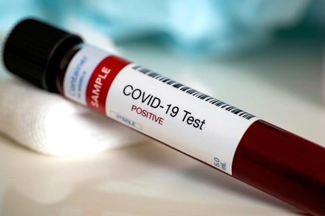 COVID-19 Test Serum